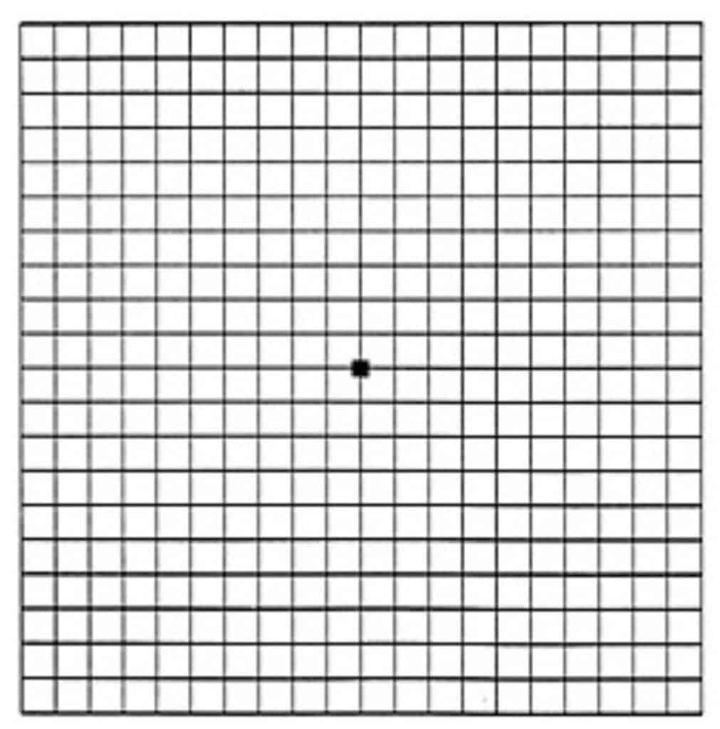 image of the Amsler grid