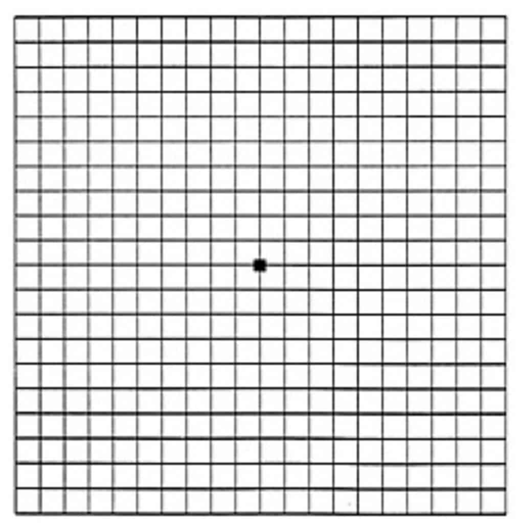 image of the Amsler grid